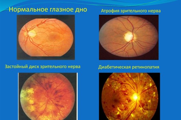 Мега кракен